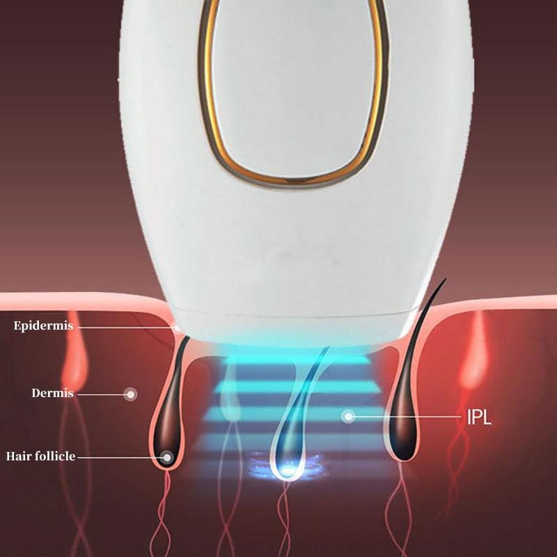 Depilador a Laser Definitivo Importado/LaserDepil - Buzz Loja